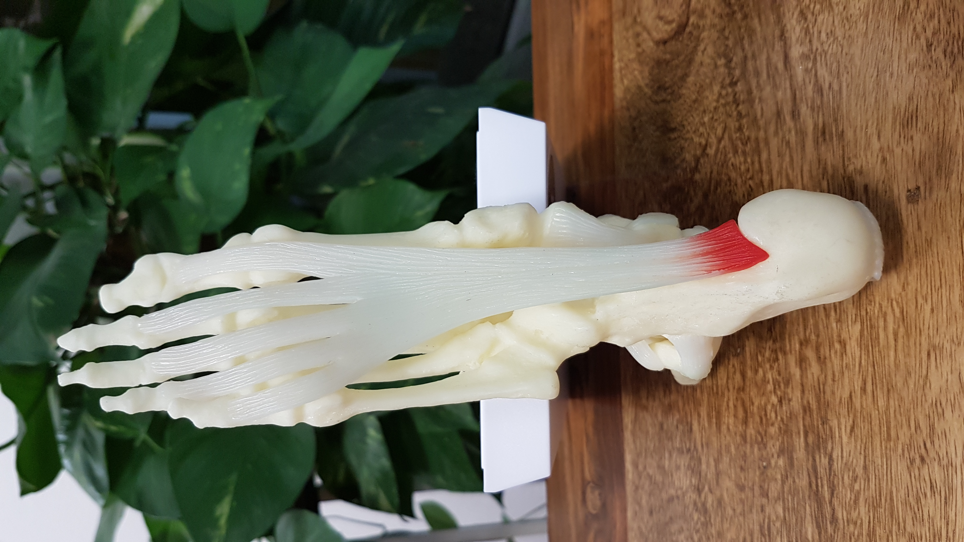 Die Plantarfaszie (Aponeurosis plantaris)